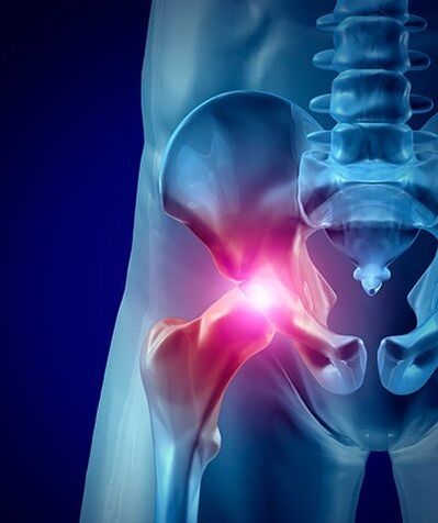 Φωτογραφία πόνου στο ισχίο 1